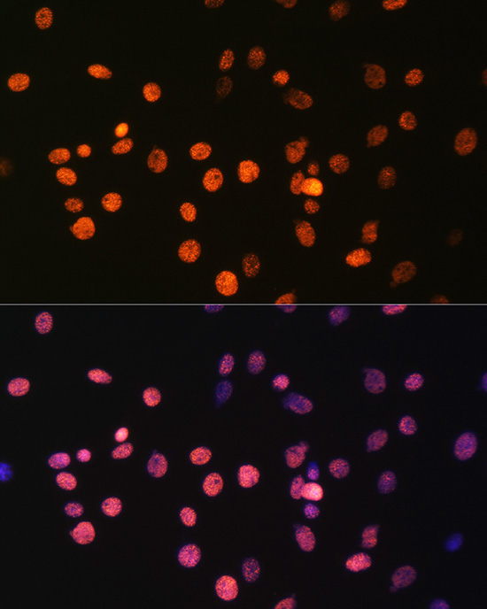 MonoMethyl-Histone H3-R17 Rabbit Polyclonal Antibody - Image 6