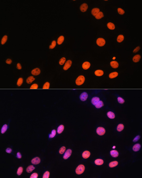 MonoMethyl-Histone H3-R17 Rabbit Polyclonal Antibody - Image 7