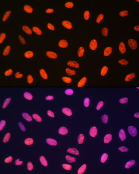 MonoMethyl-Histone H3-R17 Rabbit Polyclonal Antibody - Image 8