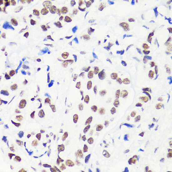 MonoMethyl-Histone H3-R8 Rabbit Polyclonal Antibody - Image 4