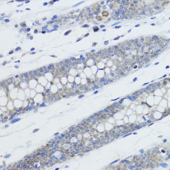 MonoMethyl-Histone H4-K20 Rabbit Polyclonal Antibody - Image 4