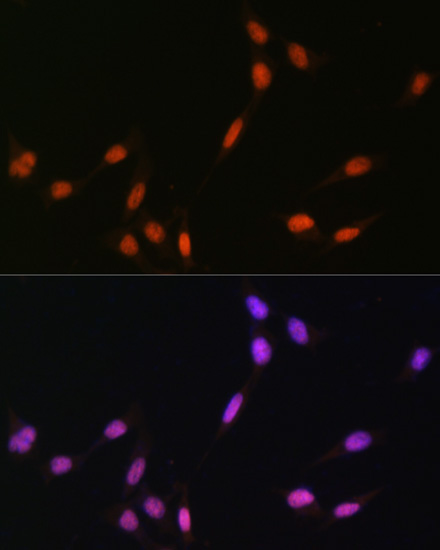 MonoMethyl-Histone H4-K5 Rabbit Polyclonal Antibody