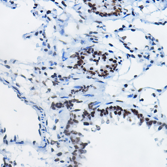 MonoMethyl-Histone H4-R3 Rabbit Polyclonal Antibody - Image 2