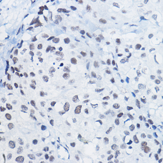 MonoMethyl-Histone H4-R3 Rabbit Polyclonal Antibody - Image 4