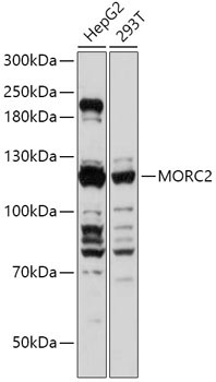 MORC2 Rabbit Polyclonal Antibody