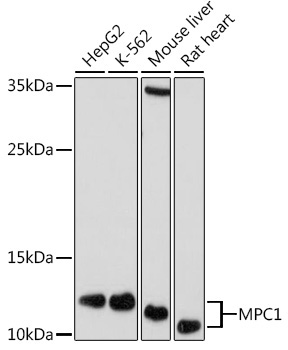 MPC1 Rabbit Polyclonal Antibody