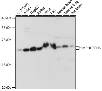 MPHOSPH6 Rabbit Polyclonal Antibody