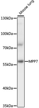 MPP7 Rabbit Polyclonal Antibody
