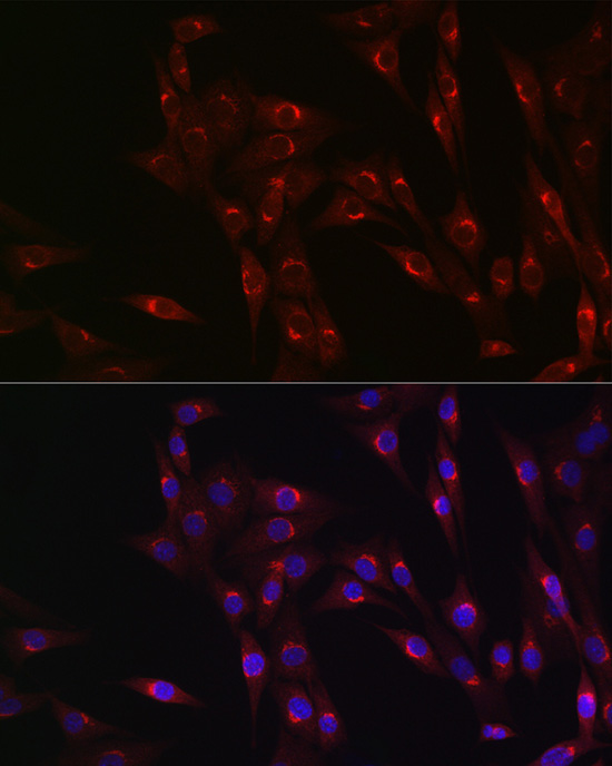 MR1 Rabbit Polyclonal Antibody - Image 2