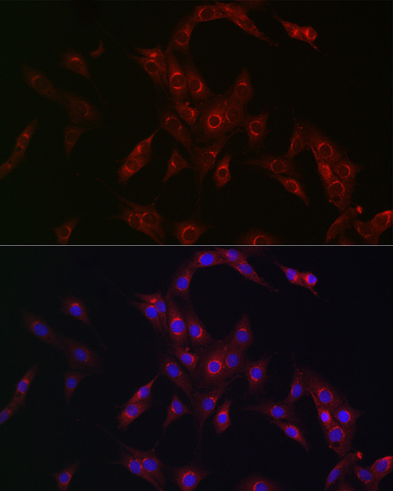 MR1 Rabbit Polyclonal Antibody - Image 3