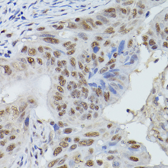 MRE11 Rabbit Polyclonal Antibody - Image 3