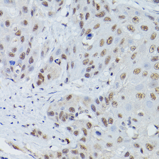 MRE11 Rabbit Polyclonal Antibody - Image 4