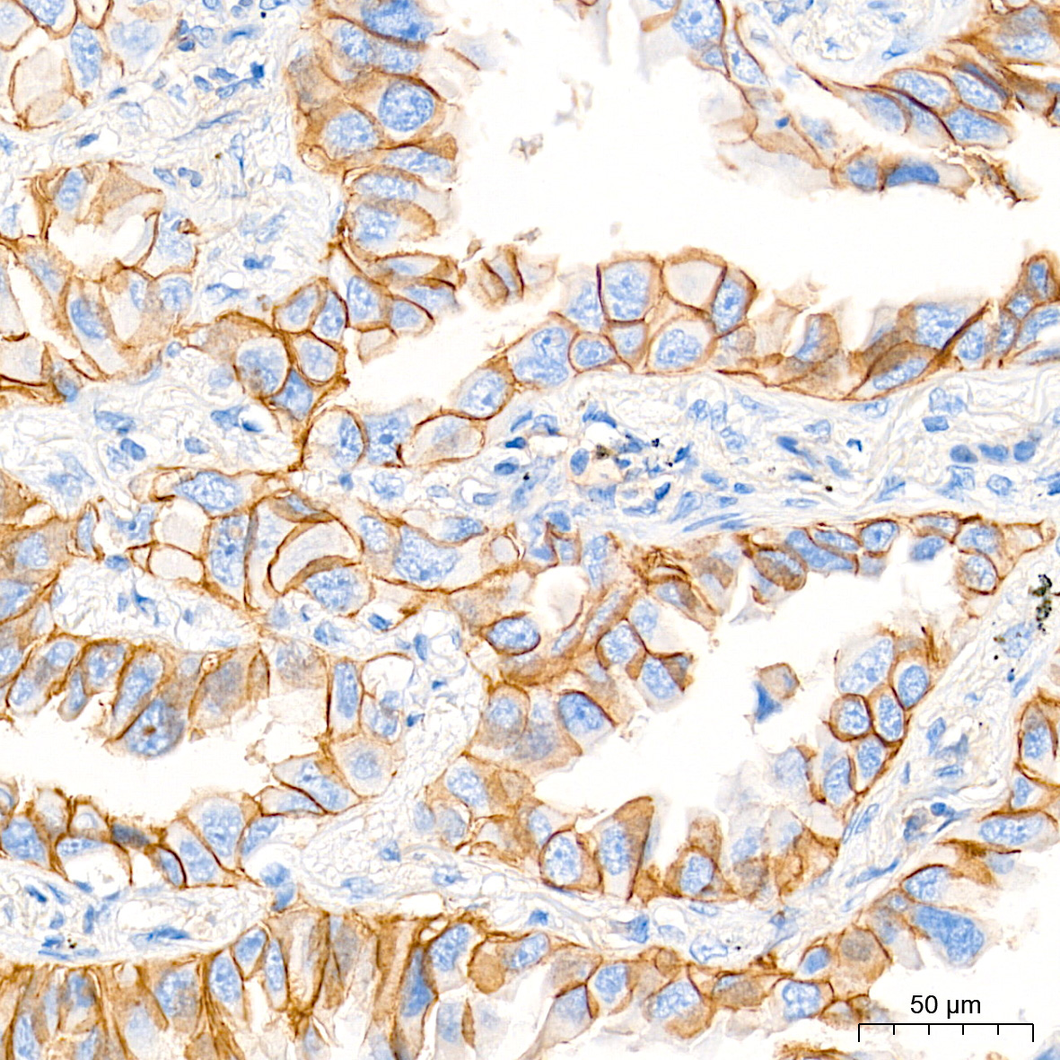 MRP1/ABCC1 Rabbit Monoclonal Antibody - Image 3
