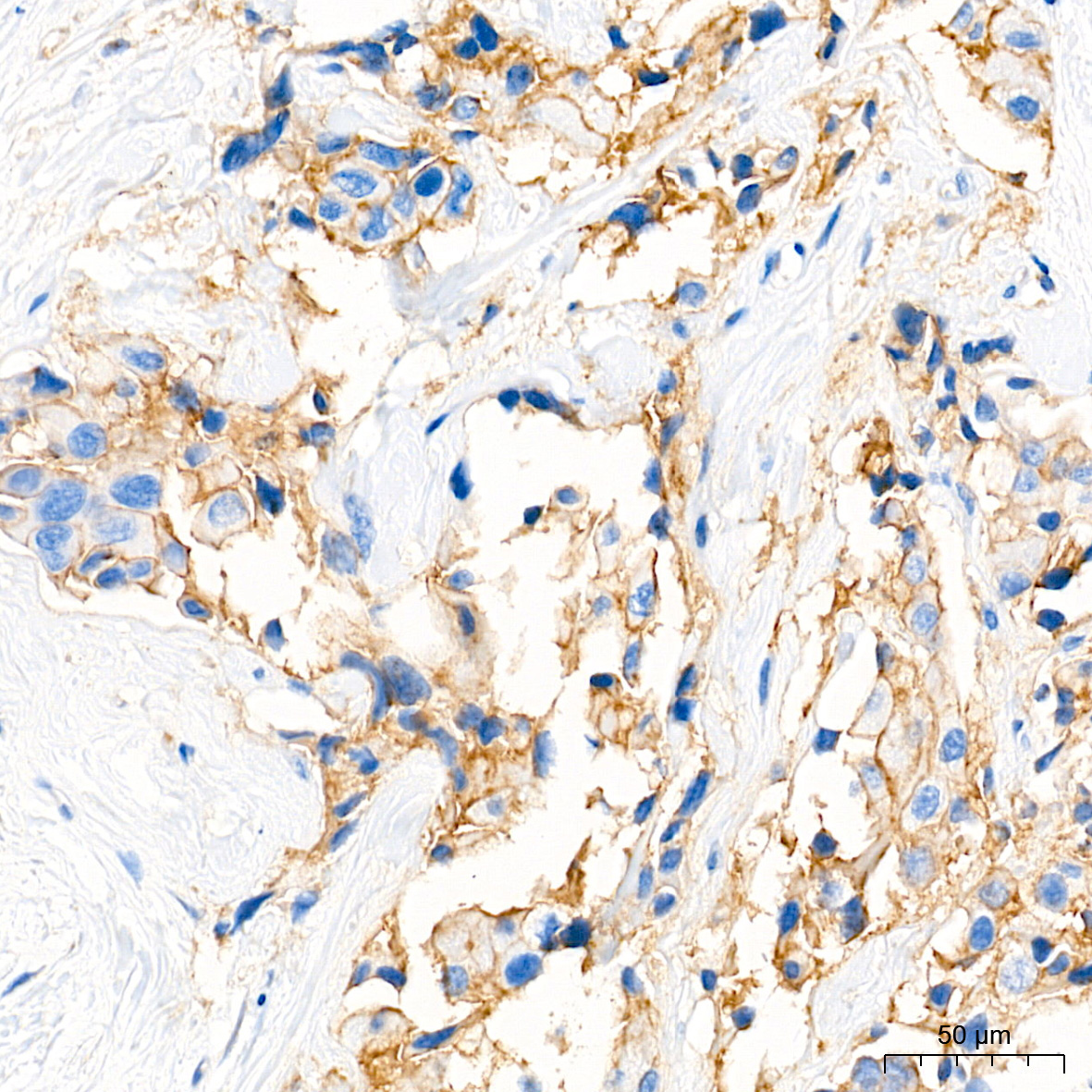 MRP1/ABCC1 Rabbit Monoclonal Antibody - Image 4