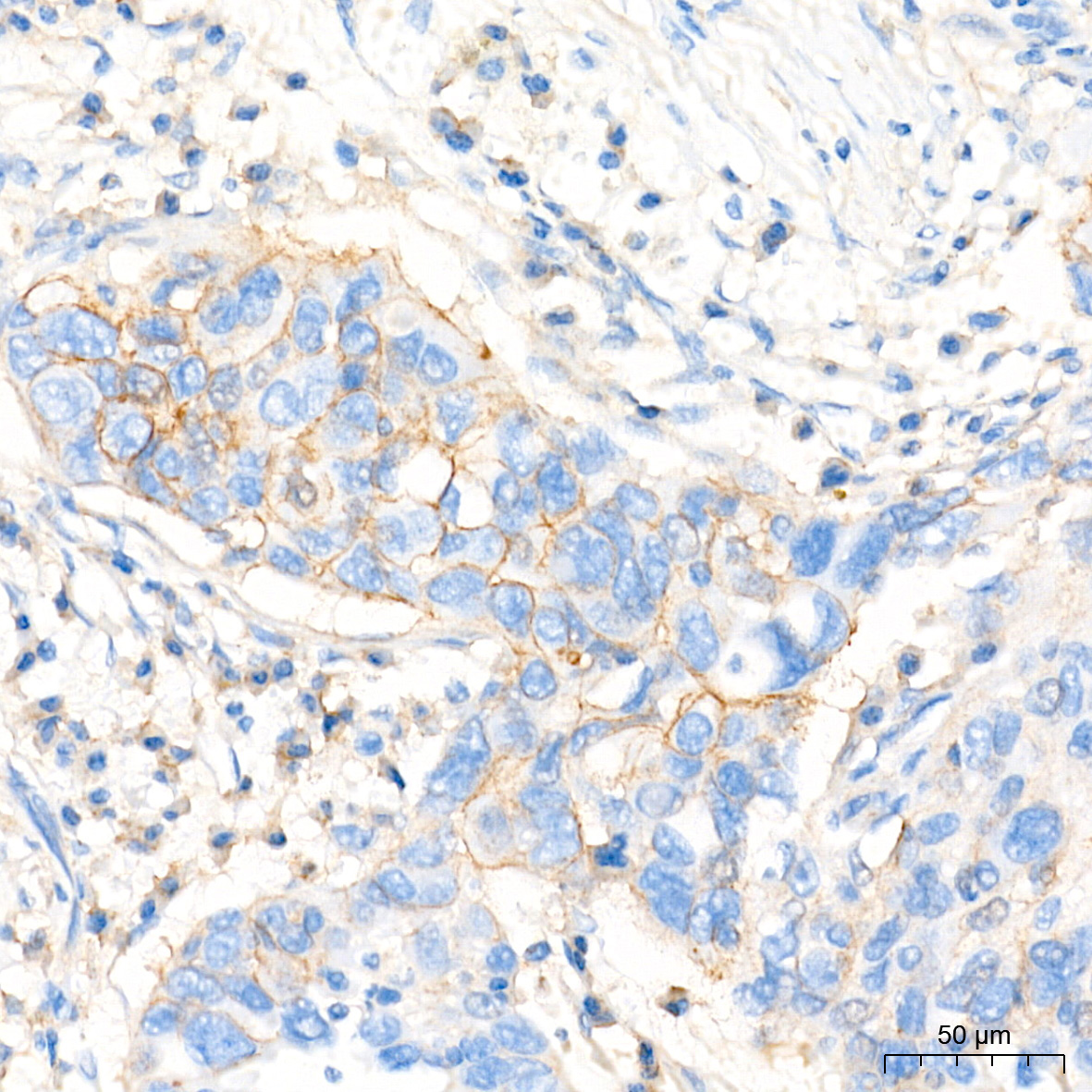 MRP1/ABCC1 Rabbit Monoclonal Antibody - Image 5