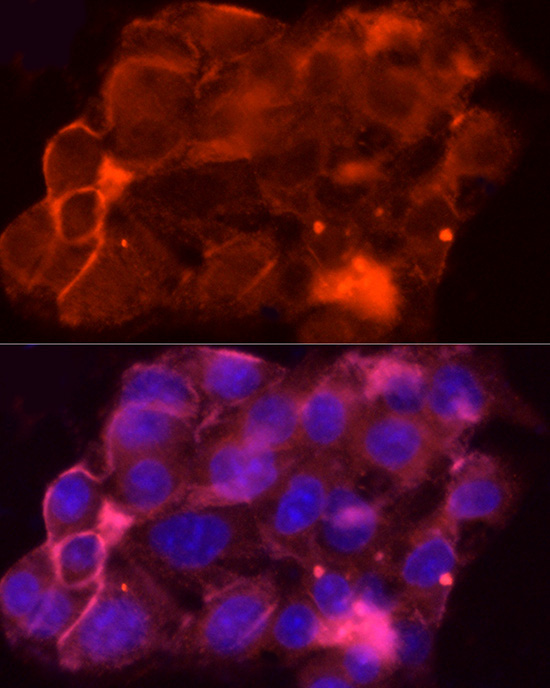 MRP1/ABCC1 Rabbit Polyclonal Antibody - Image 3