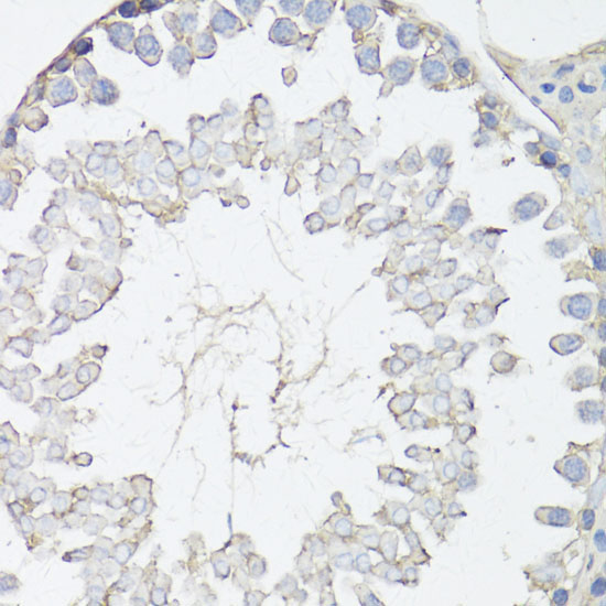 MRP4/ABCC4 Rabbit Polyclonal Antibody - Image 2