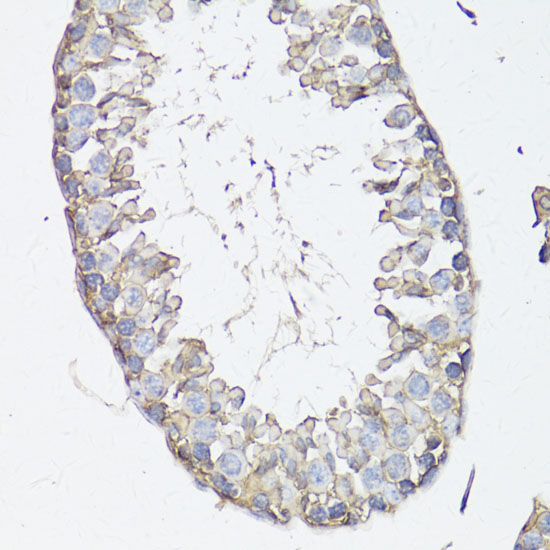 MRP4/ABCC4 Rabbit Polyclonal Antibody - Image 3
