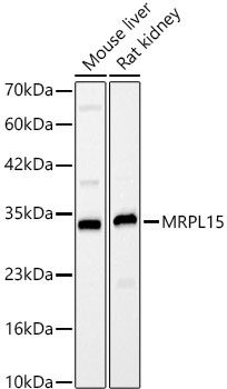 MRPL15 Rabbit Polyclonal Antibody