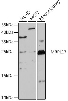 MRPL17 Rabbit Polyclonal Antibody