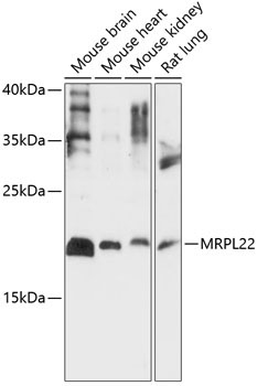MRPL22 Rabbit Polyclonal Antibody