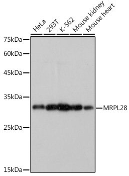 MRPL28 Rabbit Monoclonal Antibody
