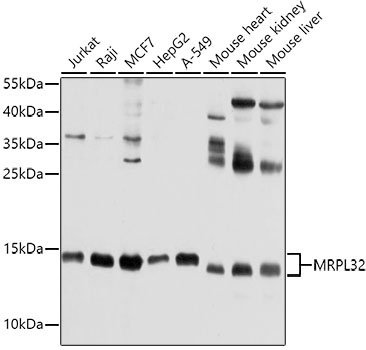 MRPL32 Rabbit Polyclonal Antibody