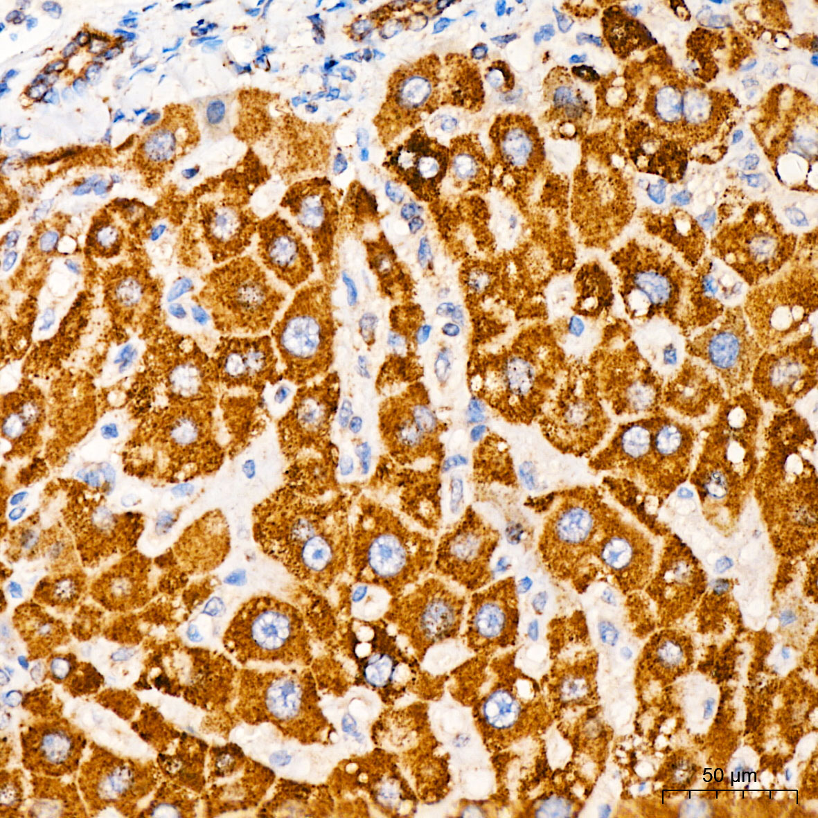 MRPL33 Rabbit Polyclonal Antibody