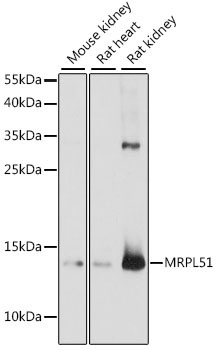 MRPL51 Rabbit Polyclonal Antibody