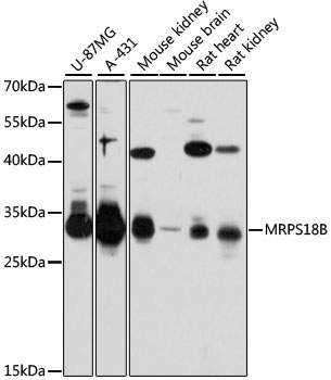 MRPS18B Rabbit Polyclonal Antibody