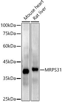 MRPS31 Rabbit Monoclonal Antibody - Image 2