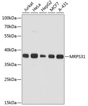 MRPS31 Rabbit Polyclonal Antibody