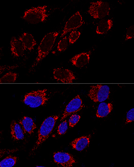 MRPS31 Rabbit Polyclonal Antibody - Image 2