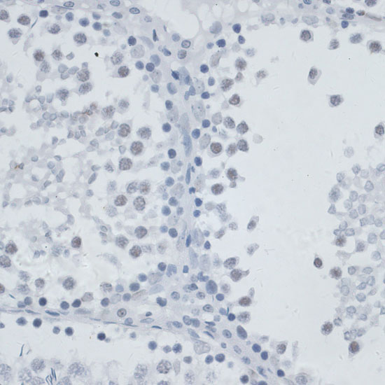 MSH6 Rabbit Polyclonal Antibody
