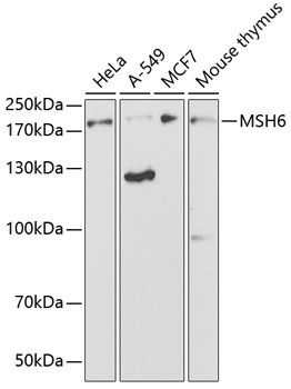 MSH6 Rabbit Polyclonal Antibody