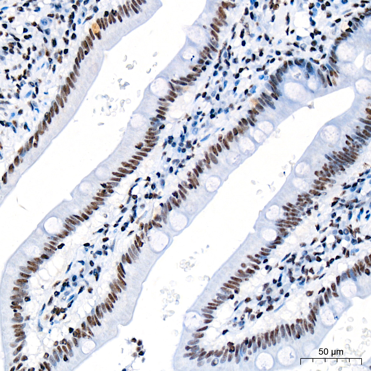 mSin3A Rabbit Monoclonal Antibody - Image 2