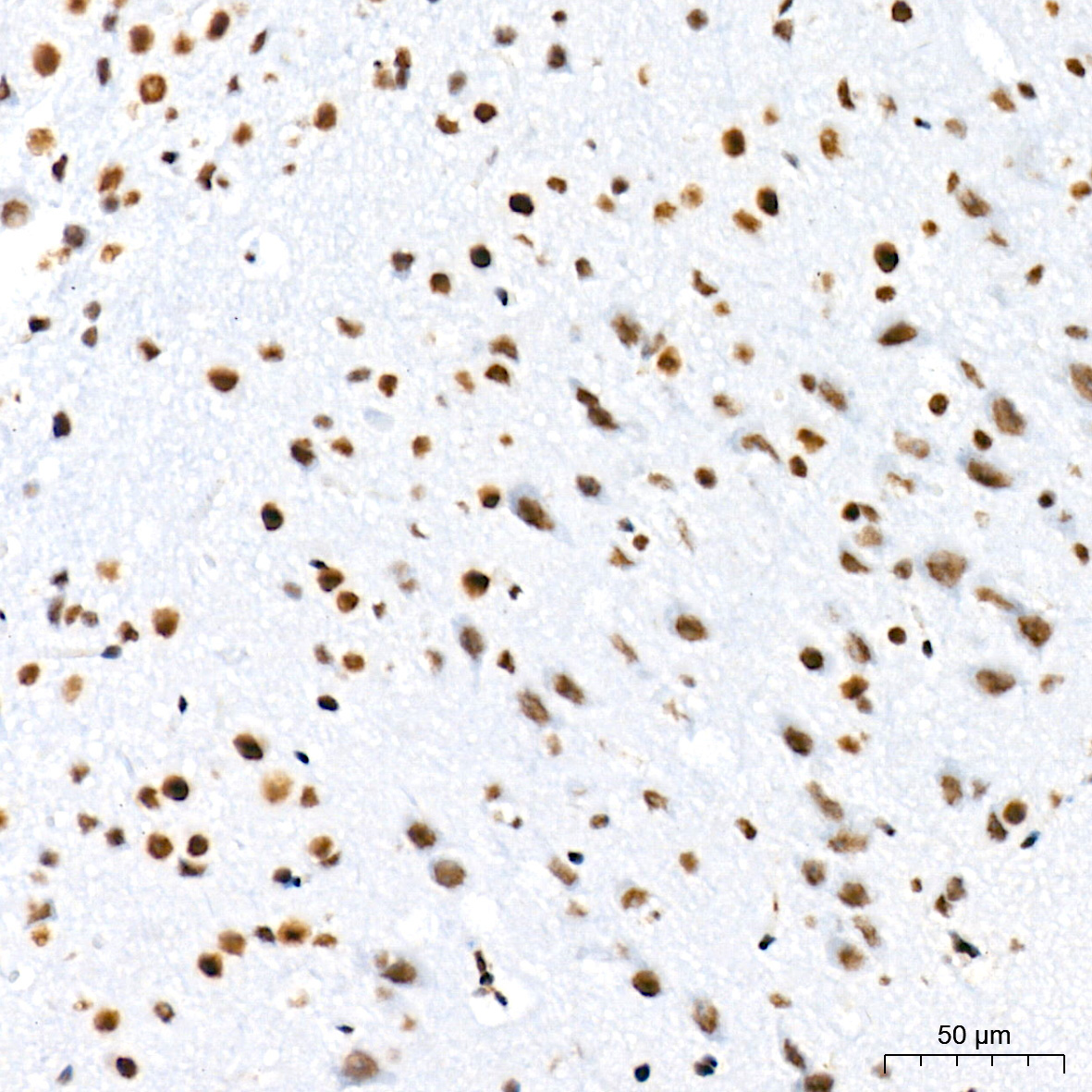 mSin3A Rabbit Monoclonal Antibody - Image 3