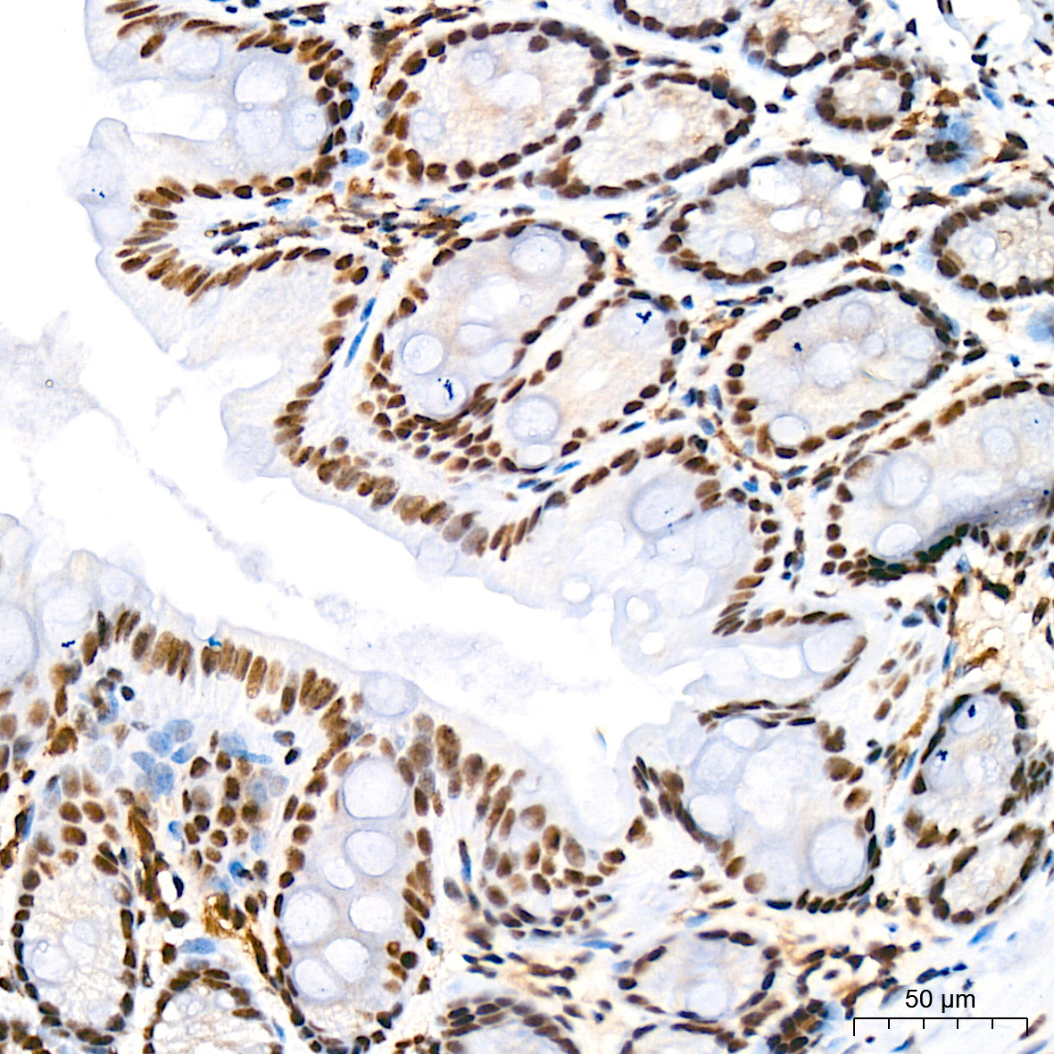 mSin3A Rabbit Monoclonal Antibody - Image 4