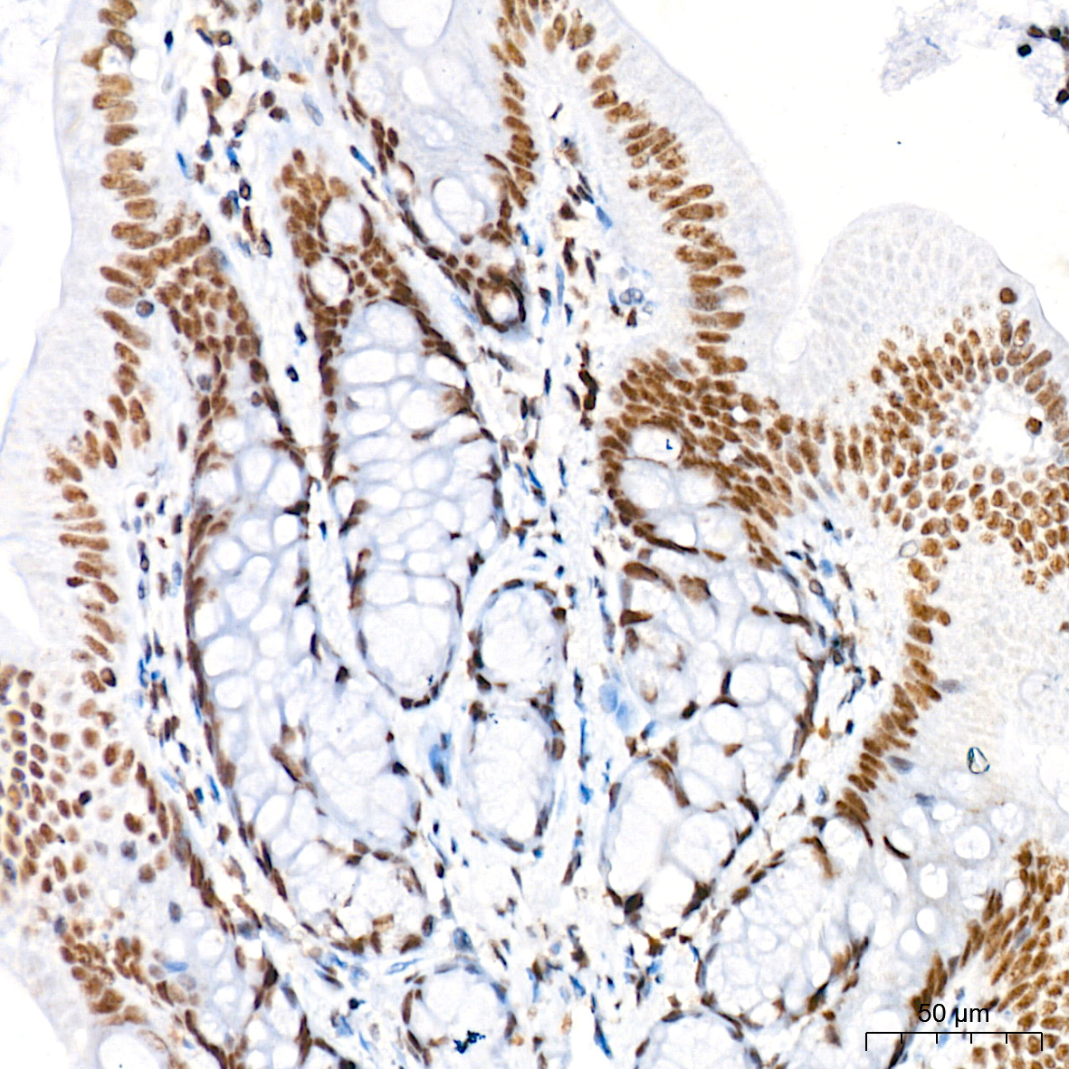 mSin3A Rabbit Monoclonal Antibody - Image 6