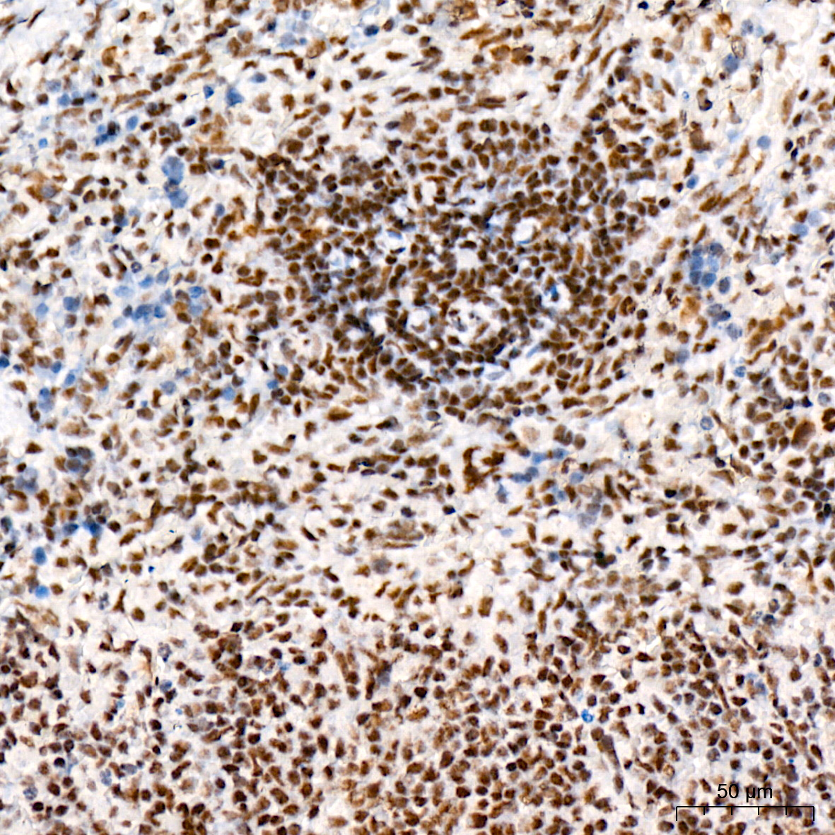 mSin3A Rabbit Monoclonal Antibody - Image 7