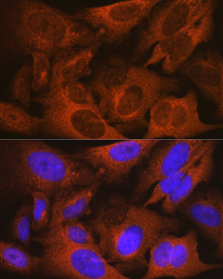 MSMB Rabbit Monoclonal Antibody - Image 2