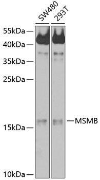 MSMB Rabbit Polyclonal Antibody
