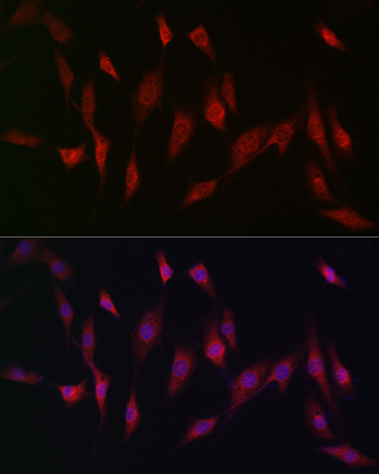 MSRA Rabbit Polyclonal Antibody - Image 2