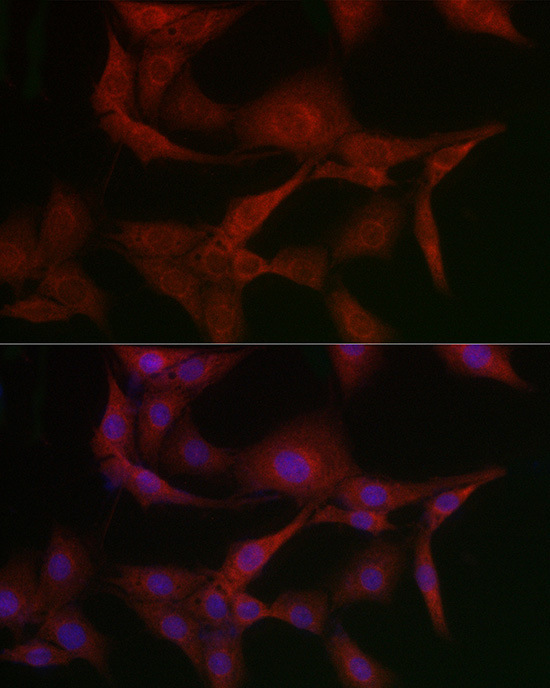 MSRA Rabbit Polyclonal Antibody - Image 3