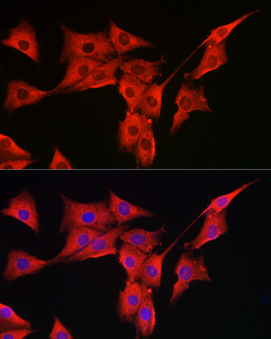 MSRA Rabbit Polyclonal Antibody - Image 4