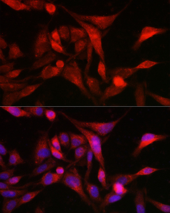 MSRA Rabbit Polyclonal Antibody - Image 5