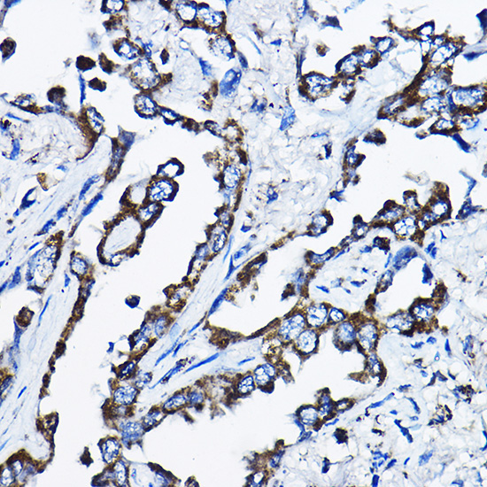 MSRB2 Rabbit Polyclonal Antibody - Image 2