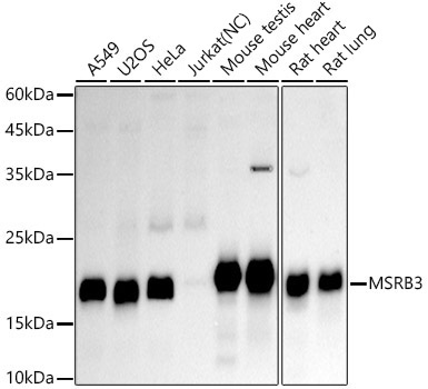 MSRB3 Rabbit Monoclonal Antibody