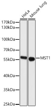 MST1 Rabbit Polyclonal Antibody
