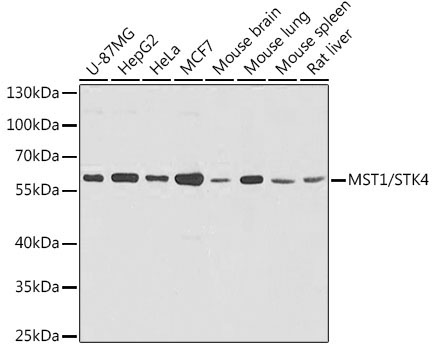 MST1/STK4 Rabbit Polyclonal Antibody